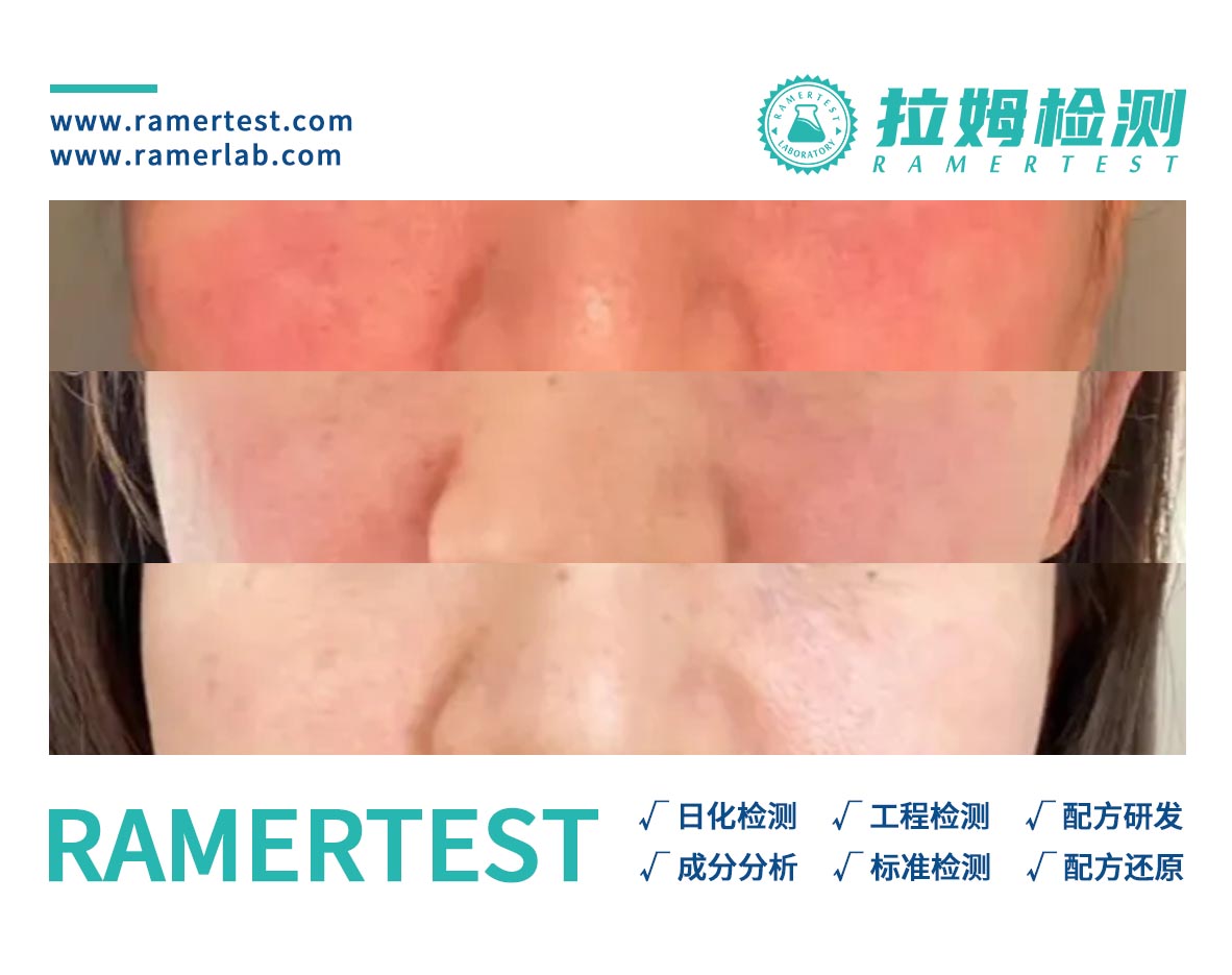 拉姆检测订阅号图2 拉姆检测订阅号图2